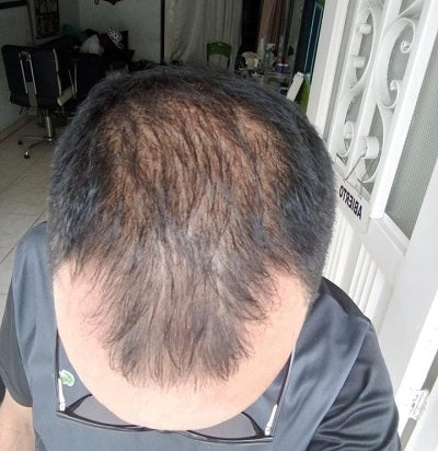 FIBRAS CAPILARES TOPPIK 27,5G