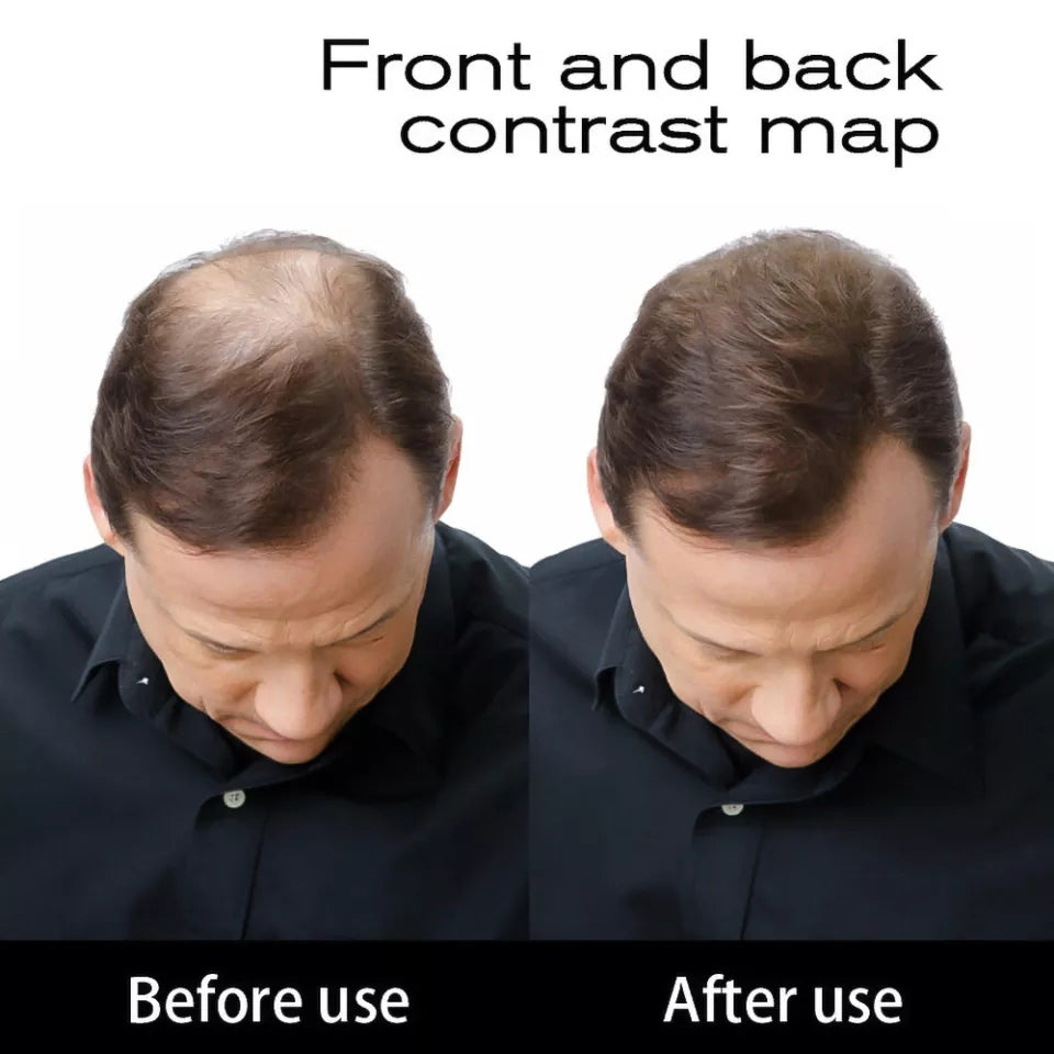 FIBRAS CAPILARES TOPPIK 27,5G